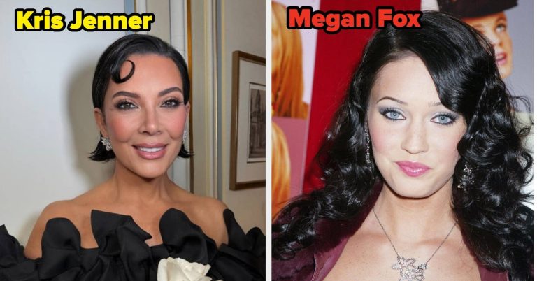 27 Celebrities Before and After Cosmetic Procedures
